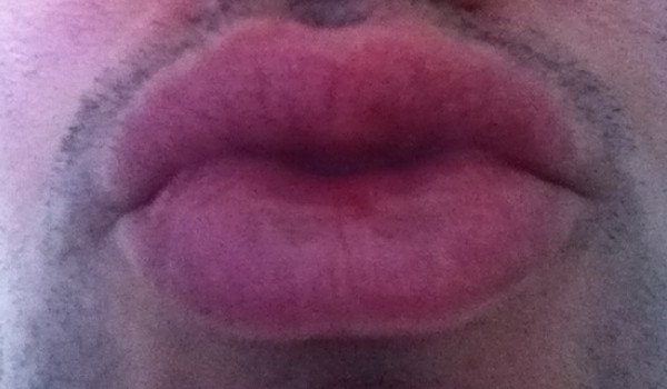 lips